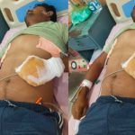 श्रीडूंगरगढ़ लगभग डेढ़ महीने से न्याय की उम्मीद में करंट से झुलसा हुआ जिंदगी और मौत से जूझता सविंदाकर्मी मुन्नीराम 